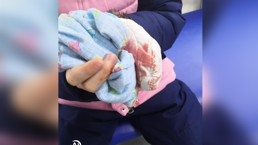 По факту нападения на ребенка в Тынде бездомных собак Следственный комитет проводит проверку - gtrkamur.ru