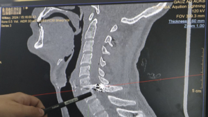 Амурчанин получил пулю в позвоночник во время отдыха с семьей - gtrkamur.ru